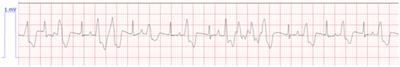 Case report: Resolution of oligo-anuric acute kidney injury with furosemide administration in a cat following lily toxicity